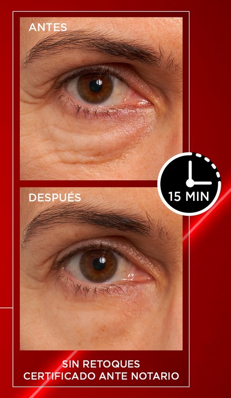 canaldis-lorealparis-Revitalift-Laser-Borrador-Bolsas-Instantáneo-efecto
