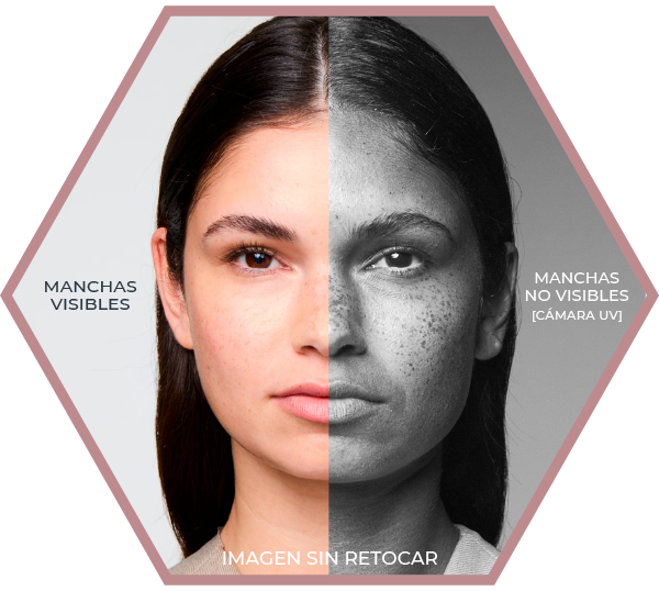 canaldis-eucerin-anti-pigment-dual-serum